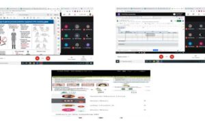 COVID SEVERITY SCORE: SOFTWARE IDENTIFIES PATIENTS LIKELY TO REQUIRE VENTILATOR SUPPORT